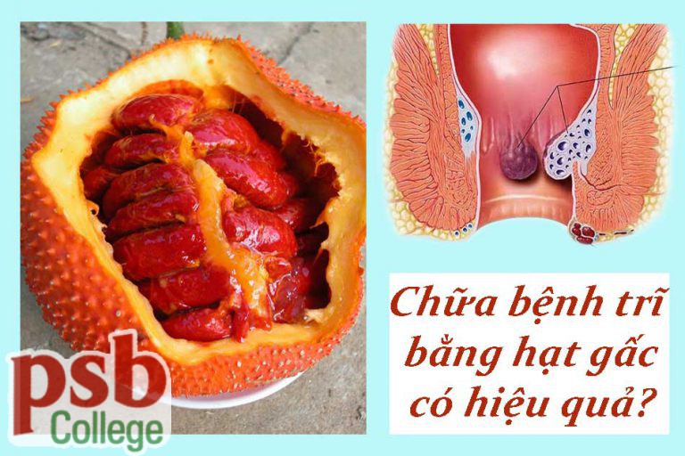 Hạt gấc chữa bệnh trĩ