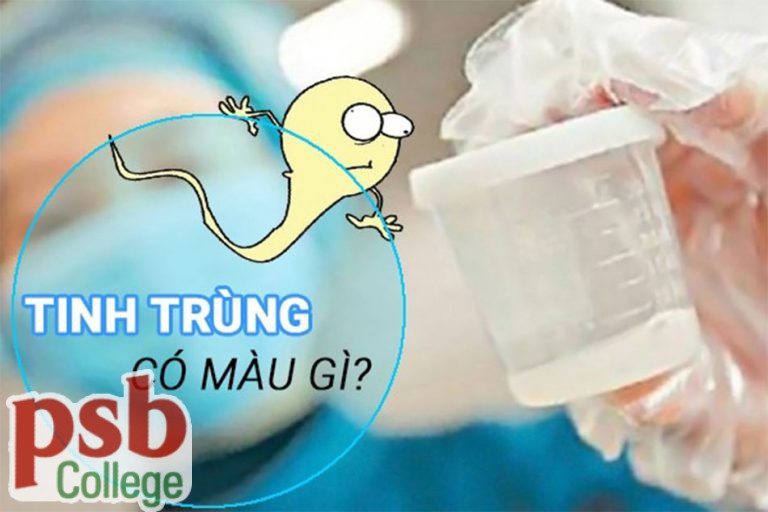 Hình ảnh tinh trùng có màu gì