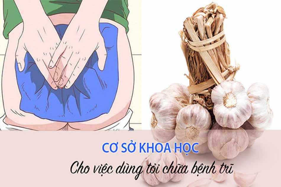 Cơ sở nào để dùng tỏi chữa bệnh trĩ?