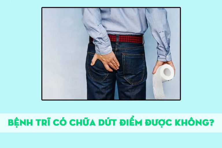 Bệnh trĩ có chữa dứt điểm được không