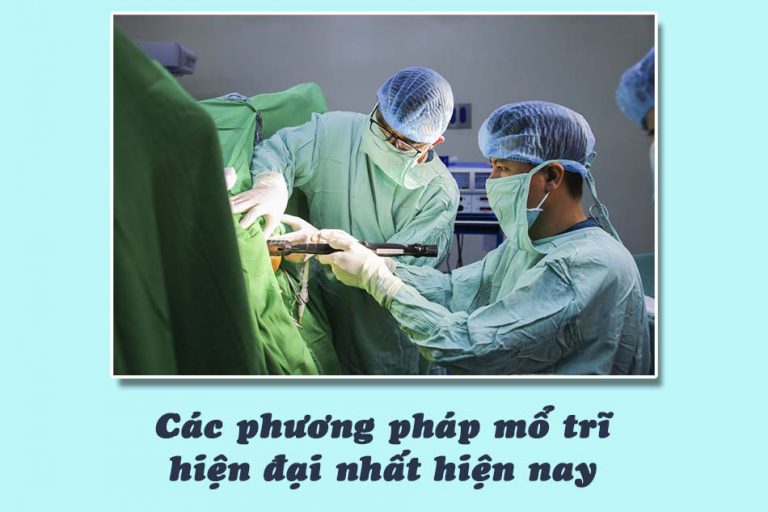 Các phương pháp mổ trĩ hiện đại nhất hiện nay