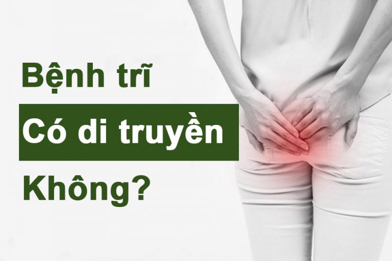 Bệnh trĩ có di truyền không