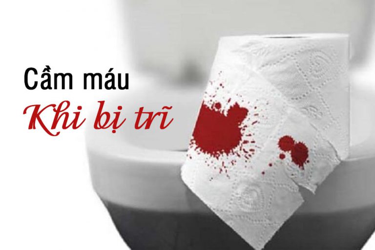 Cầm máu khi bị trĩ