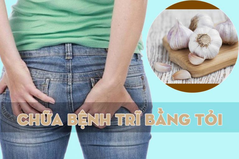 Chữa bệnh trĩ bằng tỏi